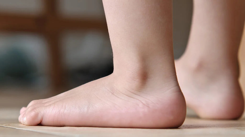 insoles for flat feet